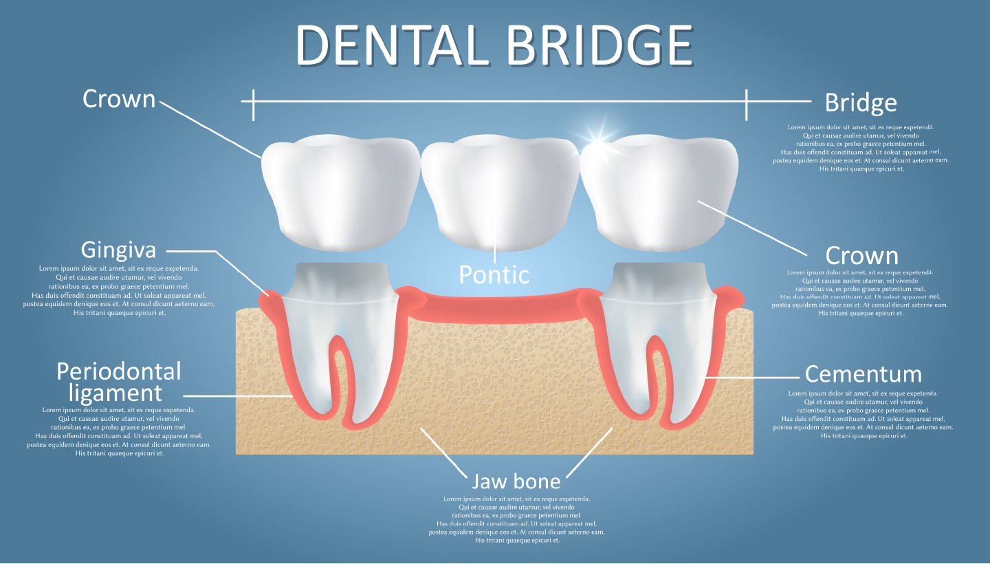Bridges Heralds Way Dentist Chelmsford