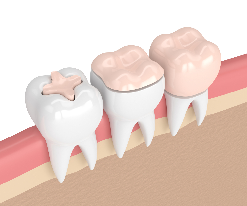 Dental Treatments 49