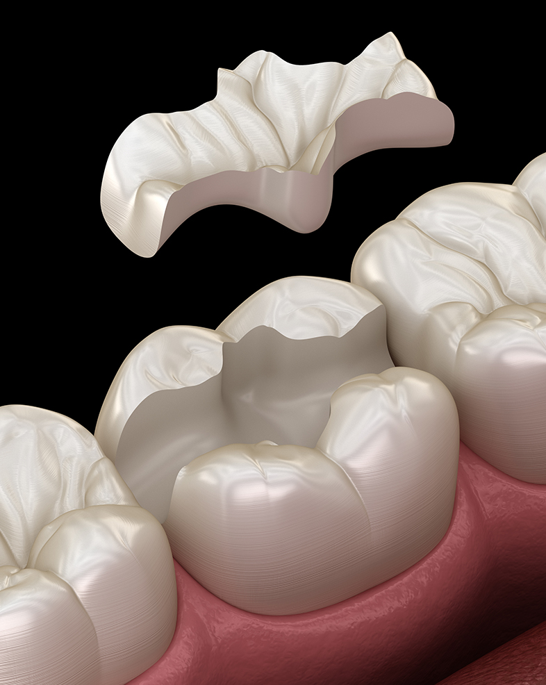 Treatment -  Heralds Way Dental